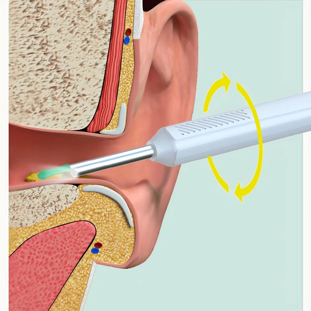Ear wax removal camera tool set, 1080P high-definition, LED light, APP viewing, with 6 replaceable spoon heads, USB charging