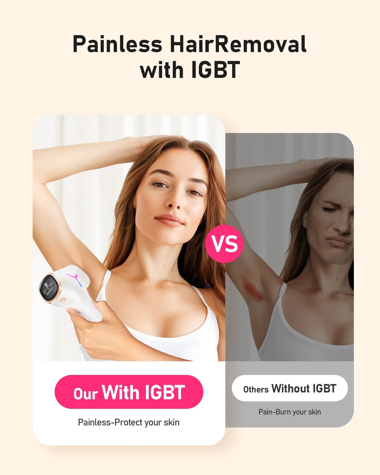 JOOYEE IPL Laser Hair Removal Epilator 3 Modes for Body